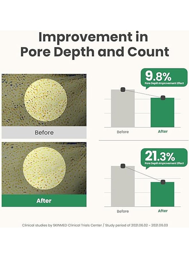 Mugwort Pore Clarifying Wash Off Mask for Acne, Pores, Oily Skin, Uneven Texture All Skin Types 100ml - image 6
