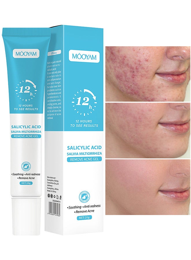 Salicylic Acid Remove Acne Gel 20G, Rapid Action Acne Spot Treatment for Face Closure And Acne Dots, Premium Acne Scar Gel And Pimple Remover