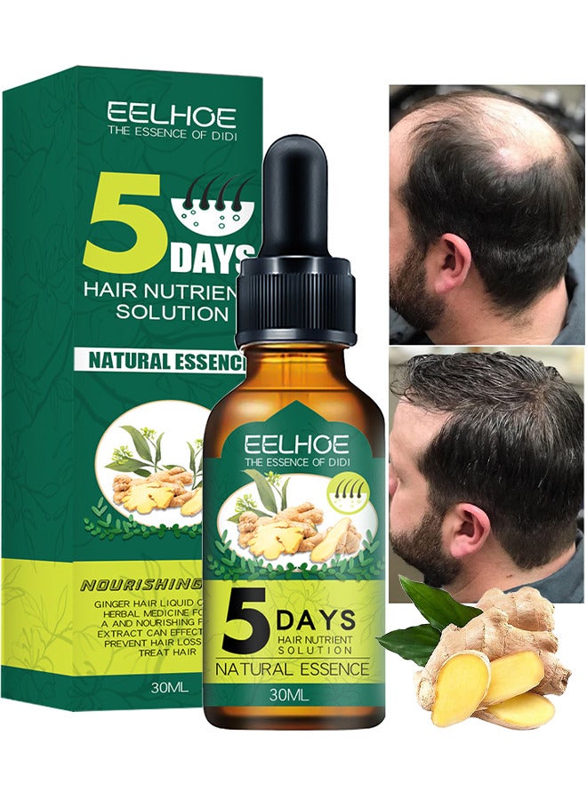Hair Growth Essence For Hair Fall Hair Regrowth And Scalp, Treatment Ginger Essential Oil Supports Healthy Hair Thinning Treatment Hair Growth Oil For Men 30ML