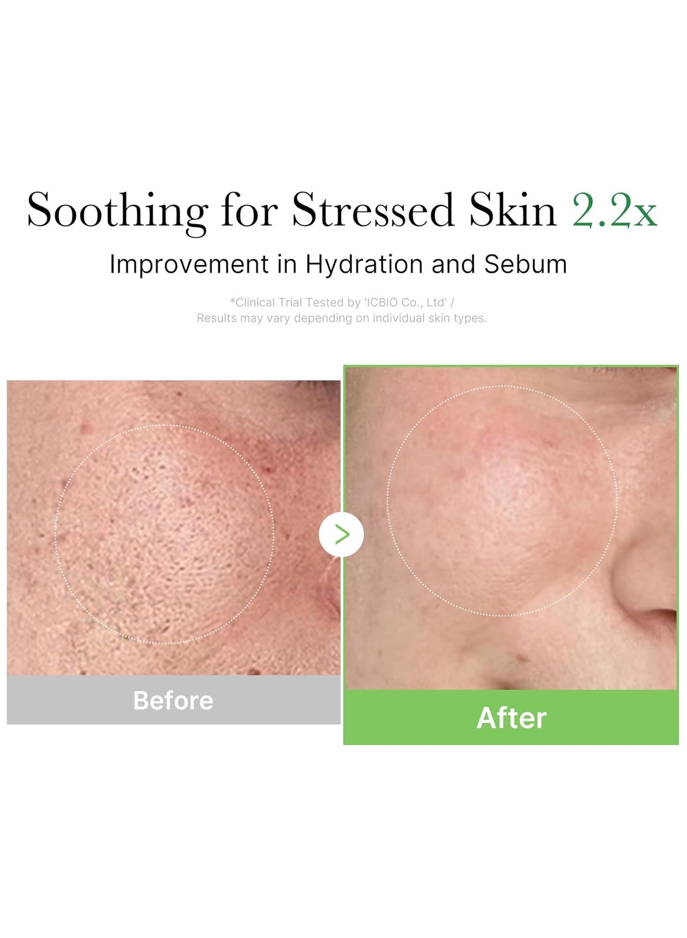 Exosome Cica Tea Tree Cream (50ml) for Sensitive & Acne Prone Skin, Soothing Moisturizer with Centella Asiatica & Exosome Technology, Redness Relief Hydrating Face Cream for Breakouts & Skin Barrier Repair - image 6