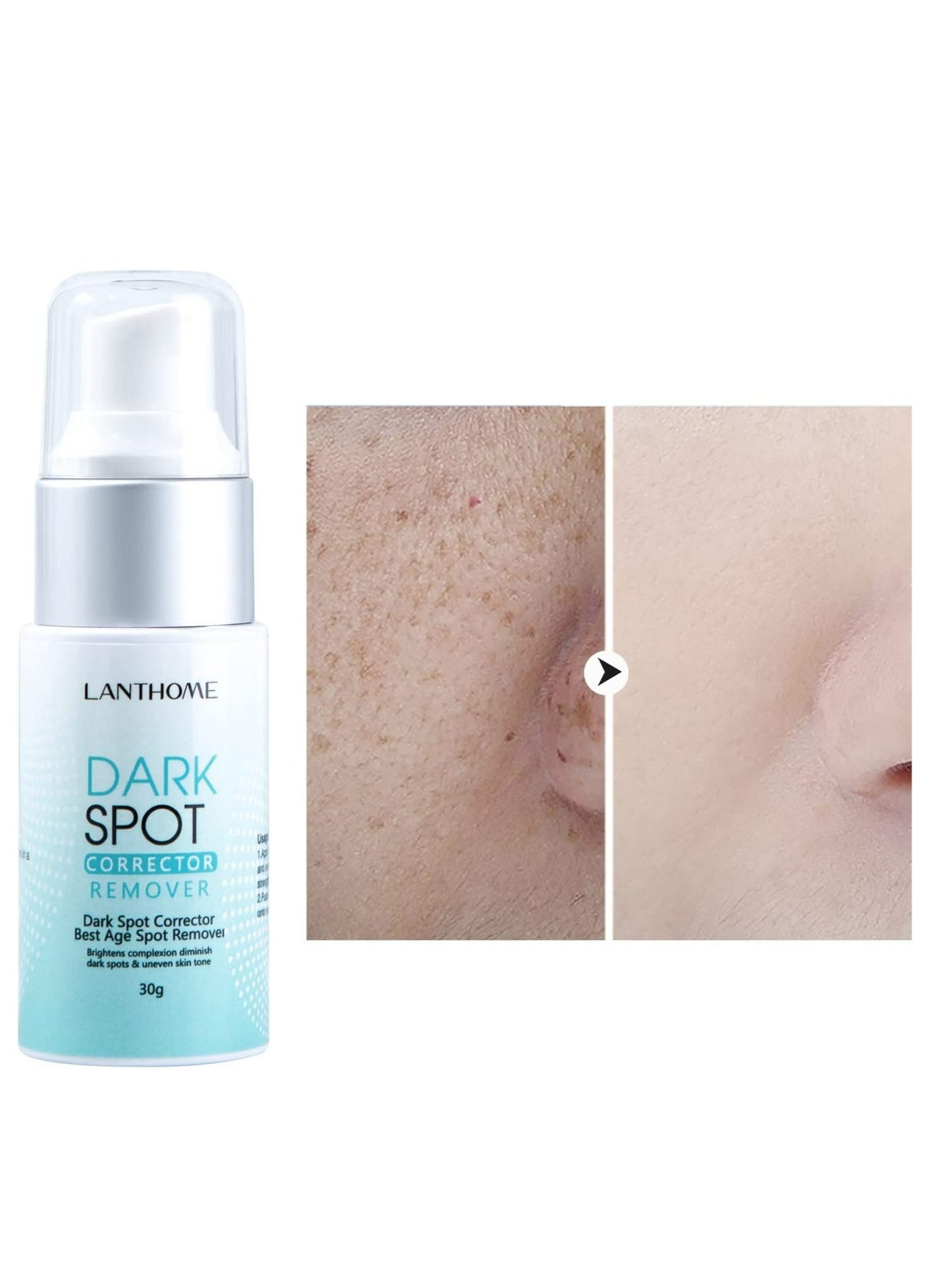 30g of Professional Dark Spots Corrector and Remover For Both Men And Women