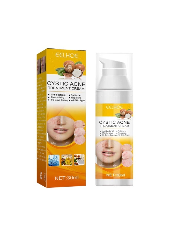 Professional Cystic Acne Cream – Deep Repair, Redness Removal, Oil Balance & Smooth Skin Moisturizer for Everyday Results