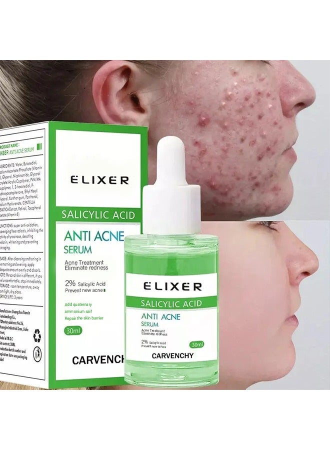 Salicylic Acid Anti Acne Serum-Salicylic Acid Oil Control Acne Treatment Essence, Anti-Acne Exfoliating Gentle Salicylic Acid Serum, Promote the Renewal of Epidermal Cells, Delicate Skin 30ml