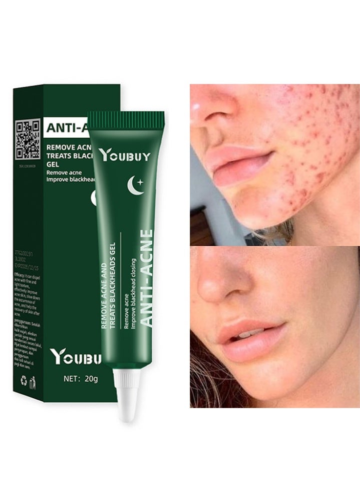 Anti-Acne Remove Acne and Treats Blackheads Gel-Night Use Remove Acne Pimple and Treats Blackhead with Salicylic Acid Oil Control Shrink Pores Redness Relief Skin Lightening Scar Fade Cream Acne Remover Cream 20g