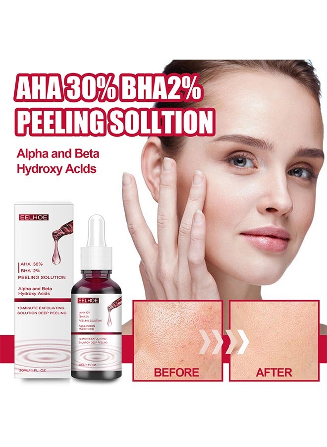 AHA30%+BHA 2% Peeling Solution，salicylic acid essence,Tone Moisturizing Repair, Powerfulexfoliation and Deepcleamsingofpores,30ml