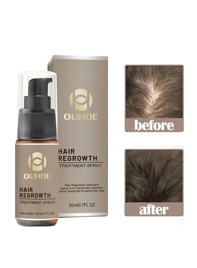 Hair Regrowth Treatment Spray,  7 Day Rapid Growth Hair Serum Essence Oil Regrow, Ginger Essential Oil Stop Hair Loss Hair, Thinning Treatment Hair Growth Oil for Women & Men 20ml