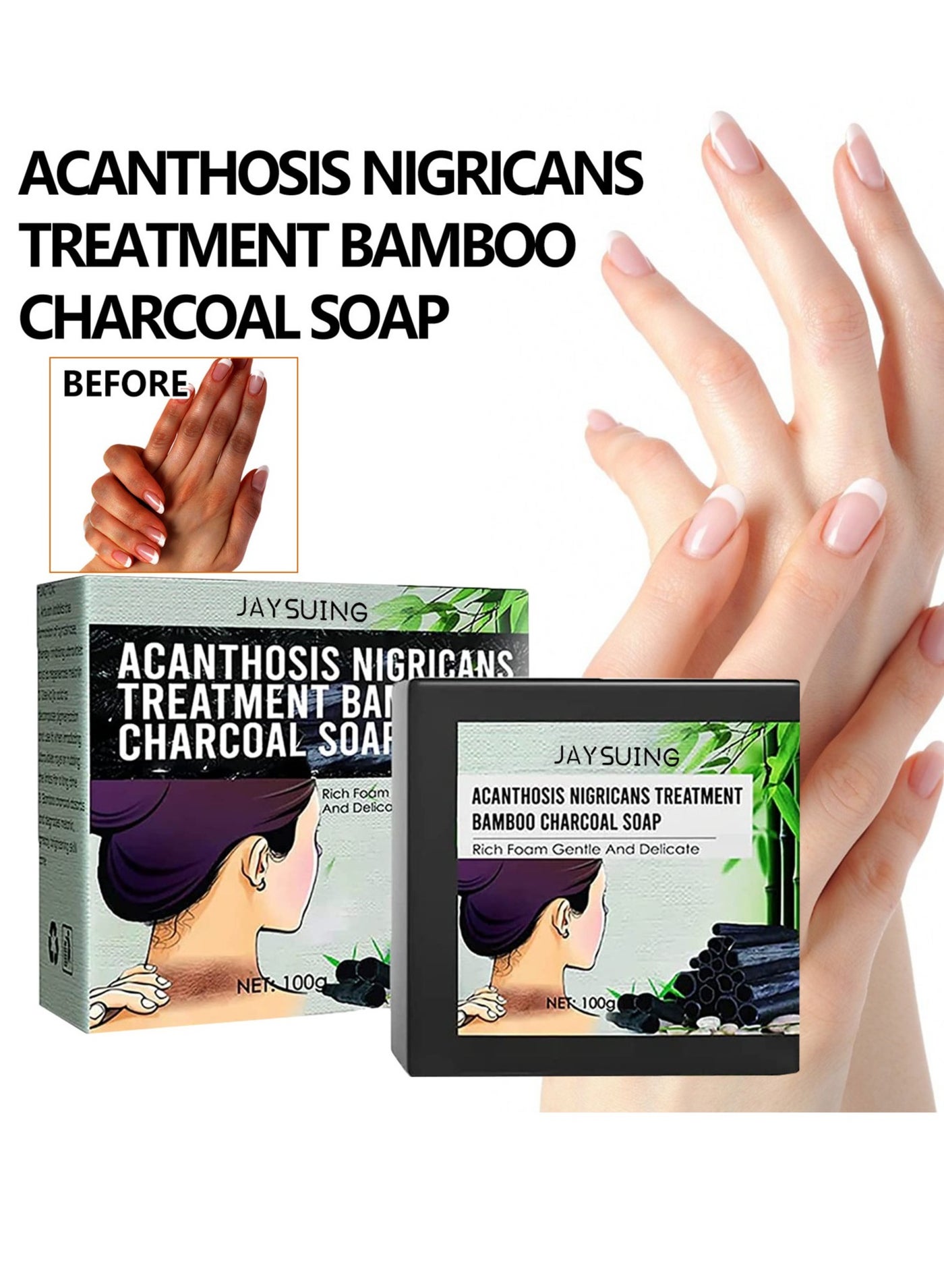 Skin Lightening Soap 100g Face & Body Dark Spots Removal， Salicylic Acid Scrub Soap, Back Acne Lighten， Removing Dark Knuckle Elbow, Underarm Whitening, Brightening Skin，Finger Joint Whitening