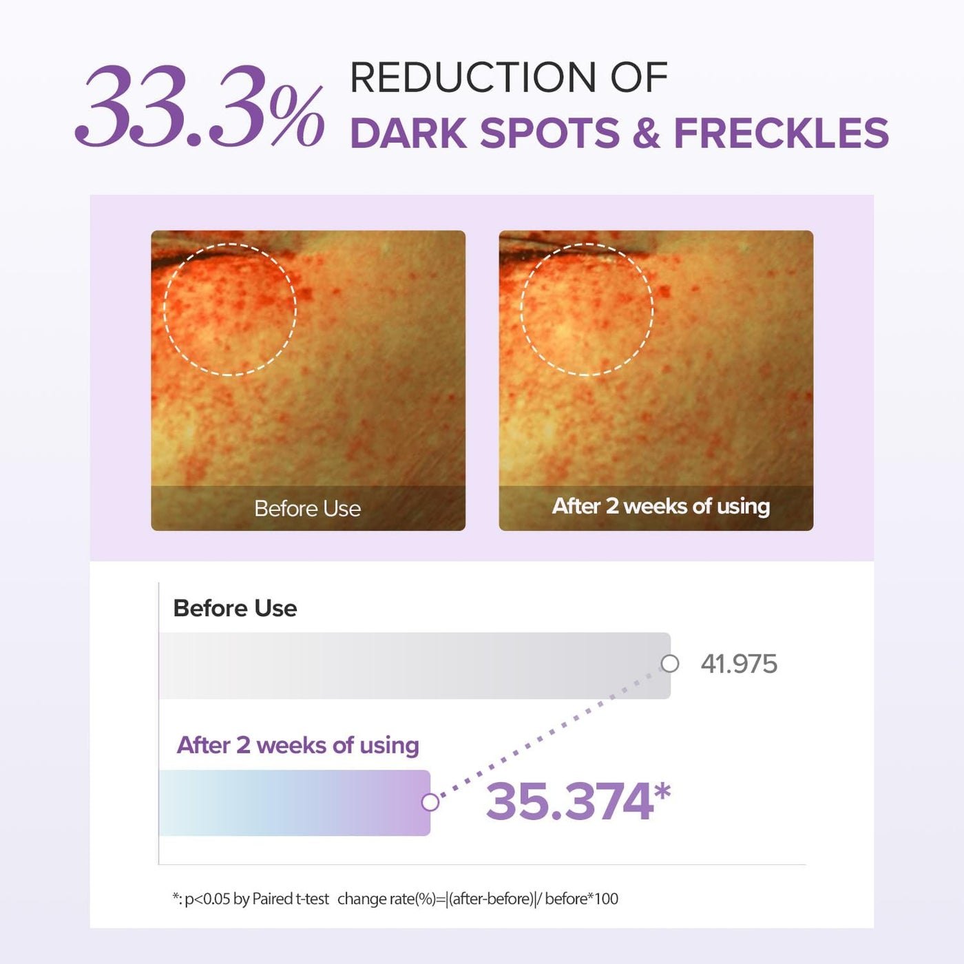 Tranexamic Acid + Glutathione Eye Cream - image 4