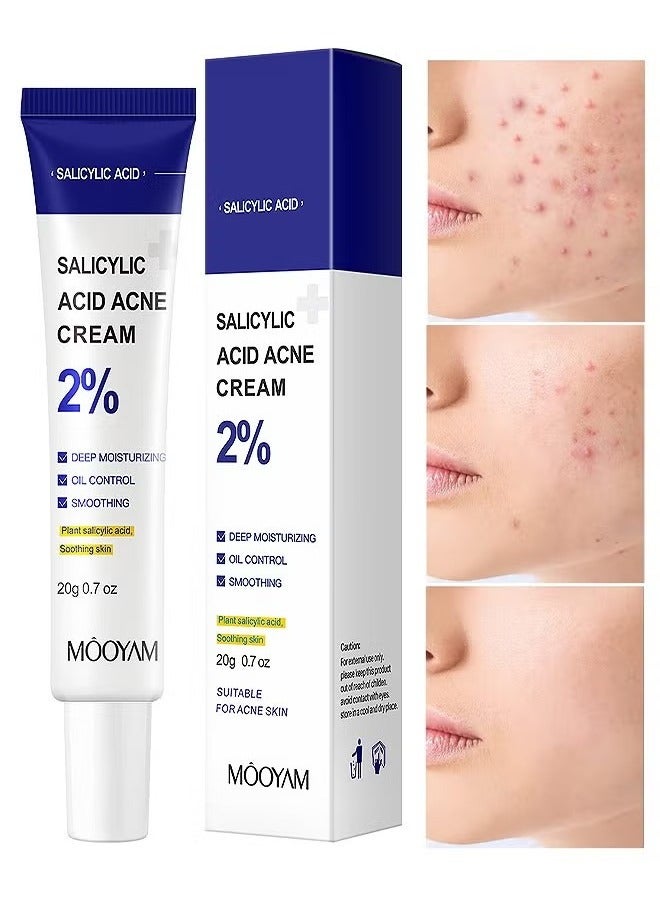 2% Salicylic Acid Acne Cream, for Face and Body Deep Moisturizing Oil Control and Smoothing with Plant Salicylic Acid and Soothing Skin Suitable for Acne Skin 20g