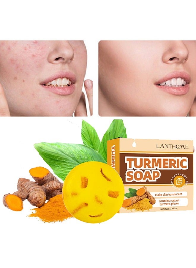 Turmeric Soap-Dark Spot Removing Soap, Face and Body Turmeric Soap, Whitening Turmeric Soap for Acne and Dark Spots,  Acne Facial Turmeric Acid Soap
