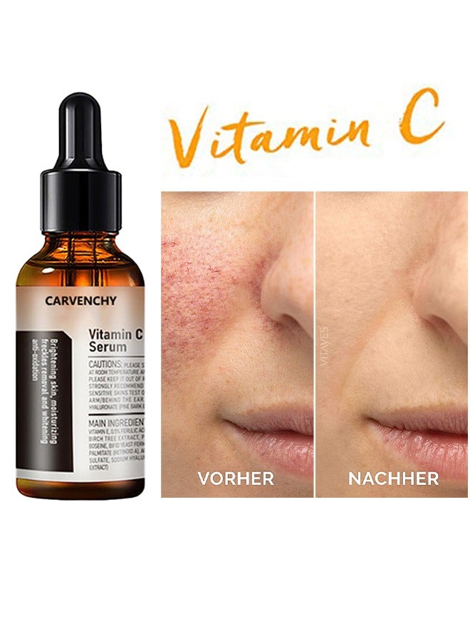 Vitamin C Facial Serum, Anti-Aging Serum with Hyaluronic Acid and Vitamin E, Moisturizing and Brightening Serum for Dark Spots, Fine Lines and Wrinkles, 30ml