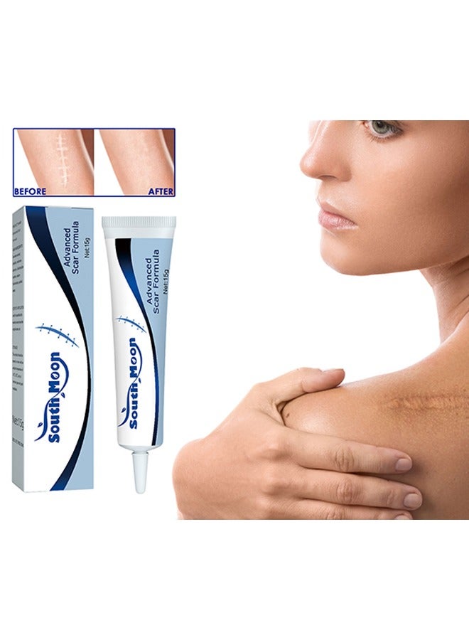 Advanced Scar Formula,Scar Repairing Gel,Wound-protecting scar gel burn wound caesarean section scar skin repair gel 15g