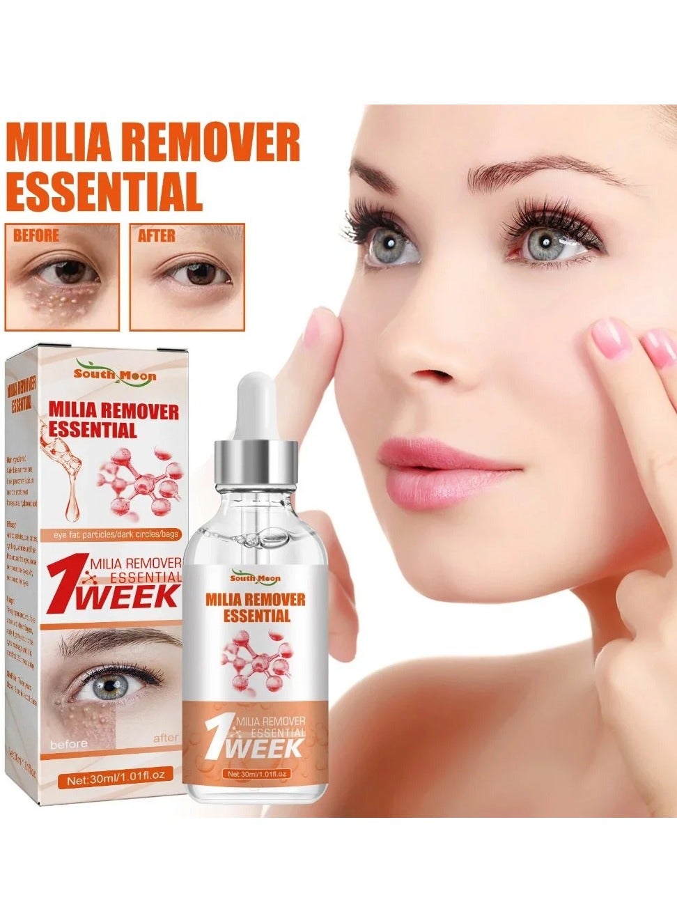 Milia Removal Essential, Milia Spot Treatment Helps Dissolve And Reduce Milia, Whitehead And Sebaceous Hyperplasia 30 ML