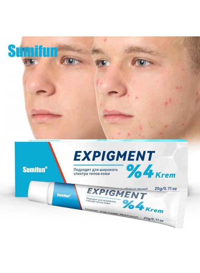 Sumifun Expigment 4% Cream – Brighten Skin & Reduce Acne Scars