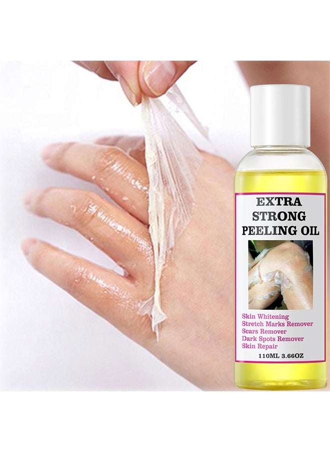 Extra Strong Peeling Oil,Yellow Peeling Oil 110ml Super Strength Dead Skin Remover Skin Moisturizing Hydrating Butter Peeling Remove Dead Skin and Calluses on Feet and Hand Dark Spot Peeling Oil