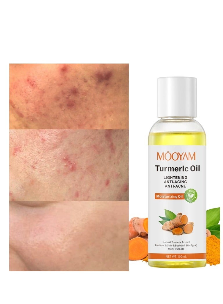 Turmeric Face Oil, Dark Spot Corrector Oil, Facial Lightening Oil for Moisturizing Skin, Anti-Acne,Anti-Aging Brightening Face Serum, Reduces Wrinkles on Face and Body, 100ml, All Skin Type