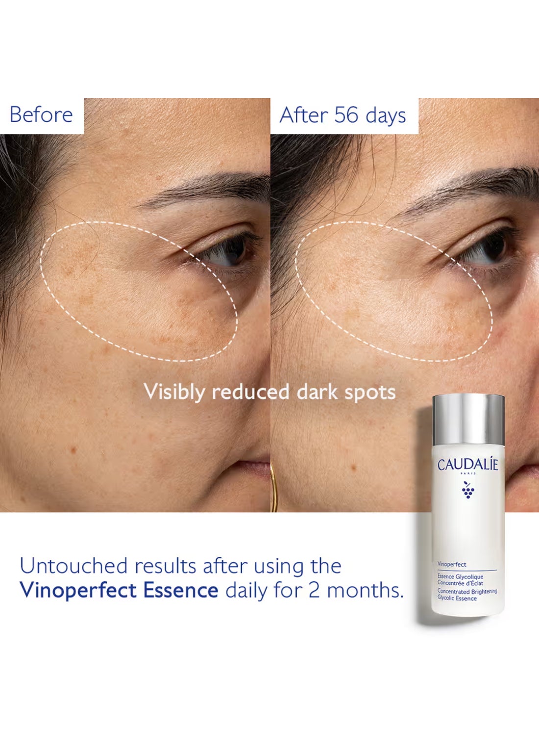 Vinoperfect Concentrated Glycolic Essence - 100 mL - image 4