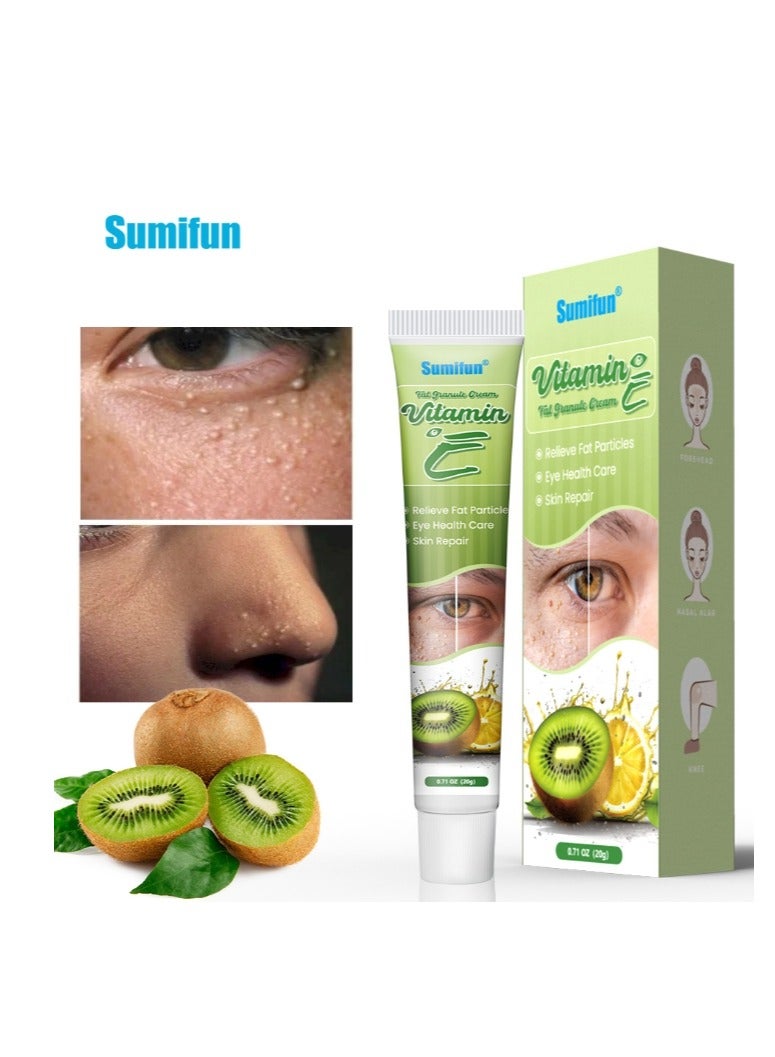 Milia Fat Granule Fat wart Grease grains Remover Ointment Fade Dark Circles Eyes Care Herb Cream Anti-Puffiness Moisturizing Essence 20G