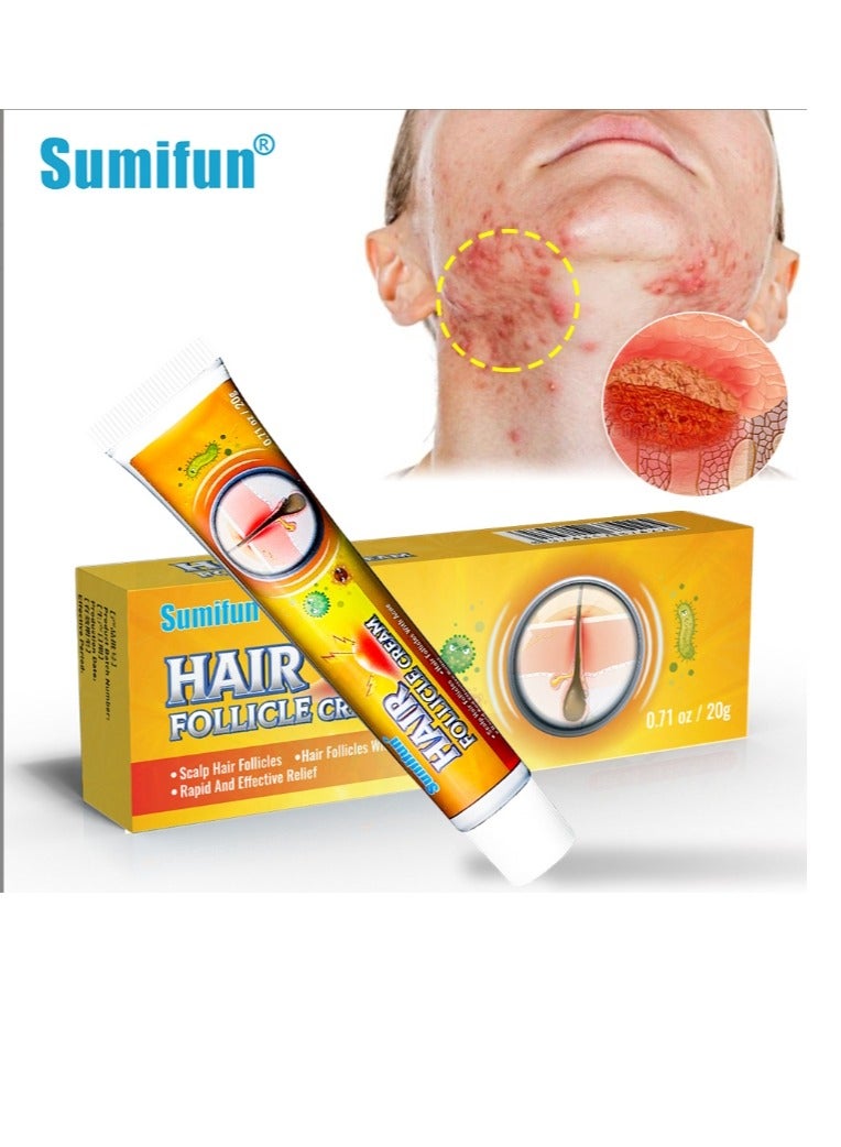 Hair Follicle cream ,Scalp Hair Follicles & Hair Follicles With Acne,Treatment for Face and body, Natural Cystic Acne Treatment, Premium Hair Follicle Cream & Pimple Remover - 20g