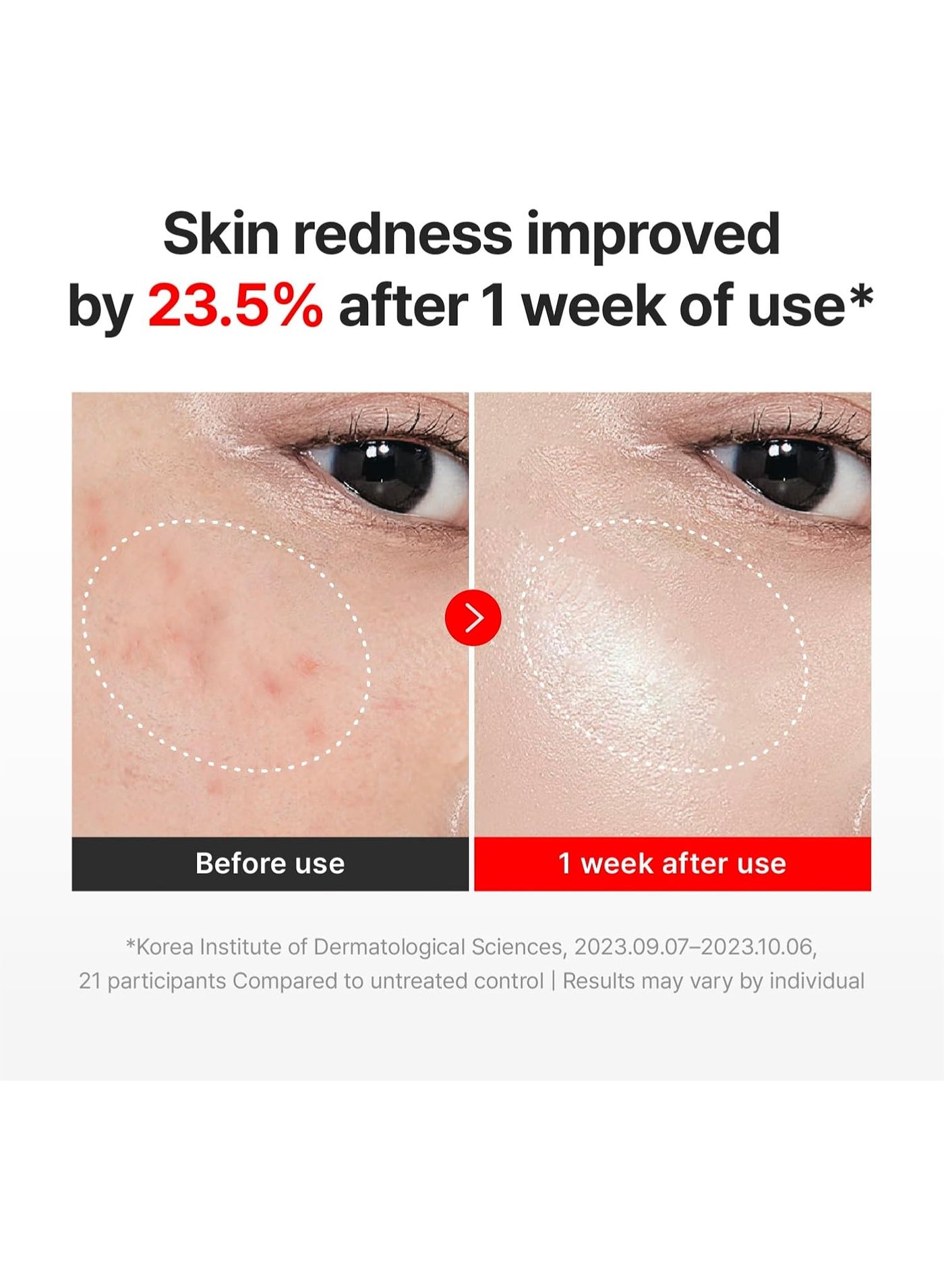CENTELLIAN 24 Madeca Cream Time Reverse (1.69fl oz) - Advanced Fast-Absorbing & Nourishing, Hydrates, Firms & Reduces Wrinkles, Low Irritation, Korean Skin Care Centella Asiatica, Collagen - image 7