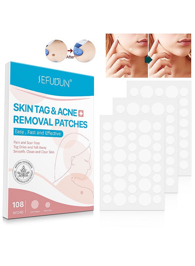 Skin Tag And Acne Removal Patches, Natural Ingredients, Painless Easy To Use Effective Fast Transparent And Ultra-Thin Design Patches For Face And Body 108 Pieces