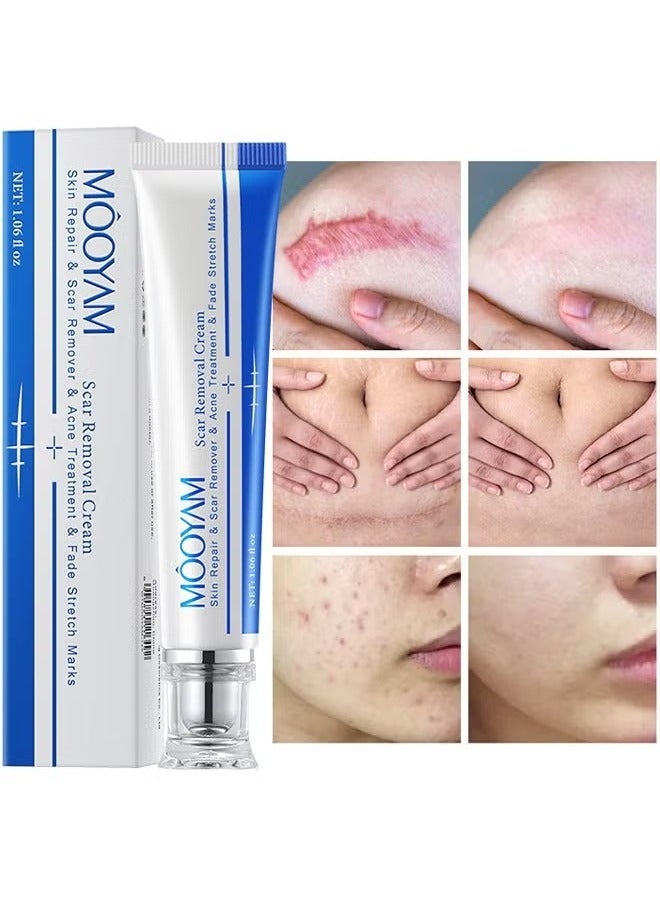 Scar Removal Cream Skin Treatment for Scars Stretch Marks and Acne Marks Improves Skin Texture with Deep Moisturization for All Skin Types