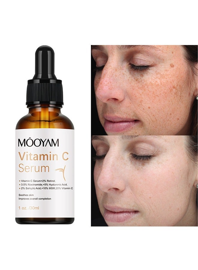 Vitamin C Serum - Brightening Skin Corrector for Face with Vitamin C and Hyaluronic Acid Boost Skin Collagen Hydrate and Plump Skin Anti Aging and Wrinkle Facial Serum 30ml