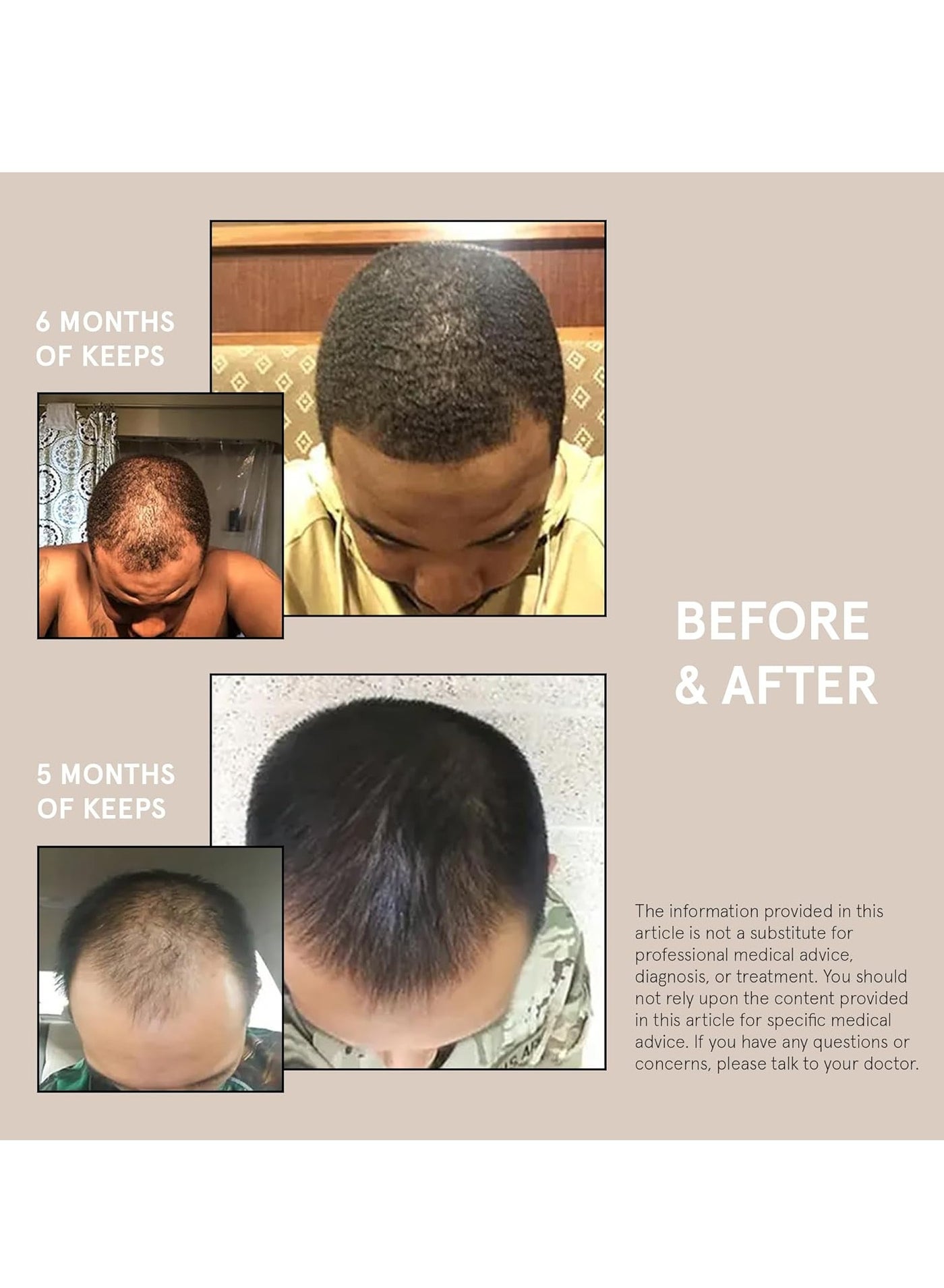 Keeps Extra Strength Minoxidil for Men - 5% Minoxidil Foam Hair Loss & Regrowth Treatment for Thinning & Bald Spots - Clinically Proven Hair Growth Products - Unscented Topical Aerosol Foam