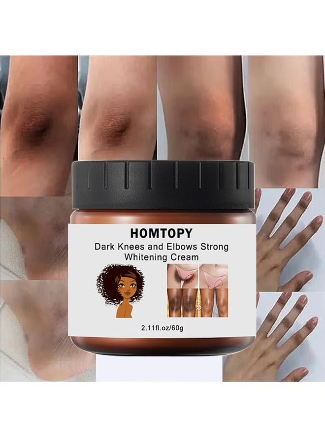 Dark Knees And Elbows Strong Whitening Cream, 60G Get Rid Of Knuckles Easily In Just 7 Days Skin Whitening Improve Skin Tone Nourishing And Moisturizing Cream