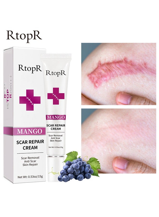 Scar Removal Cream - Skin Repair Creams Treatment Stretch Marks Acne Surgical Care 15g