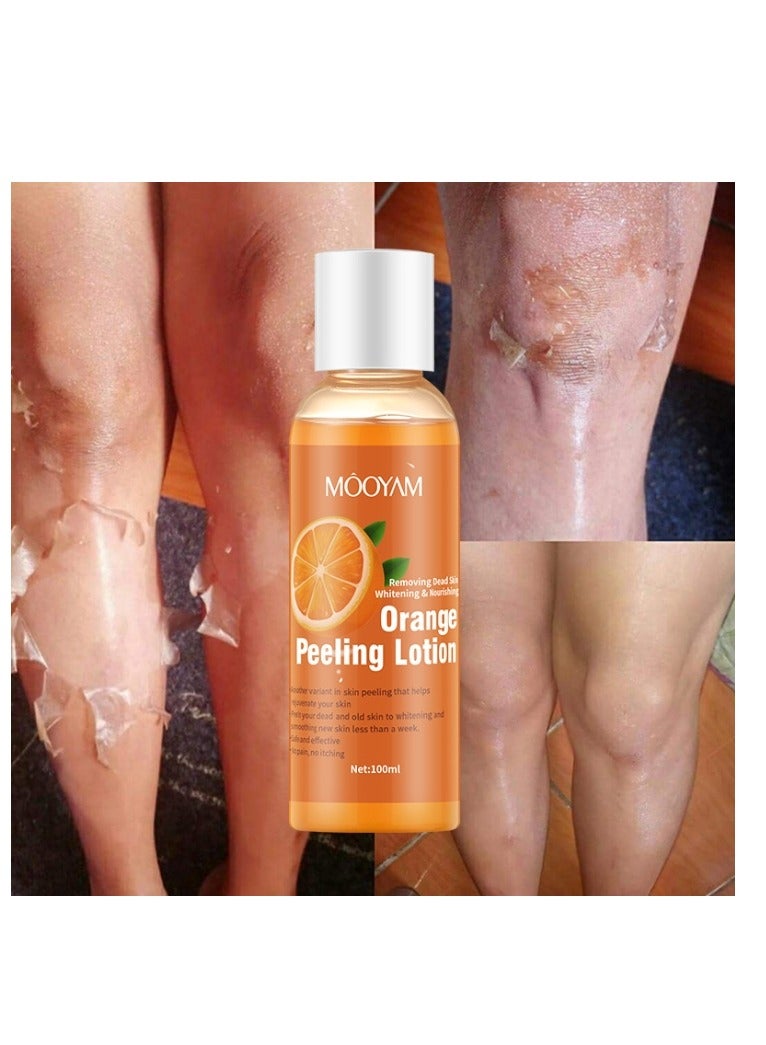 Orange Peeling Oil 100ml Super Strength Dead Skin Remover Skin Moisturizing Hydrating Butter Peeling Remove Dead Skin and Calluses on Feet and Hand Dark Spot Peeling Oil