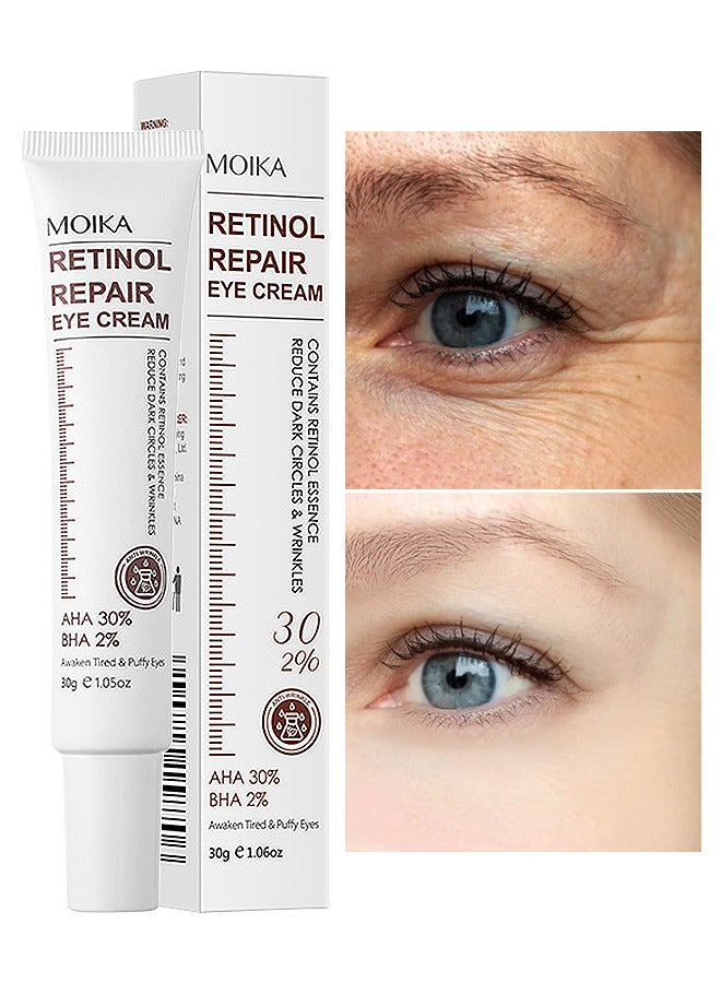 Retinol Repair Eye Cream, For Dark Circles And Puffiness, With AHA And BHA Dark Circle Fine Lines Treatment, Anti-Aging, Under Eye Treatment, Reduces Wrinkles, Defoams And Brightens Skin 30G