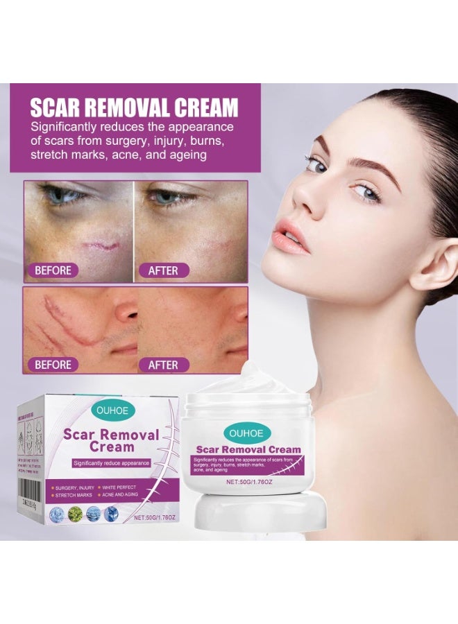 Scar Cream Fade Scald Scar Surgical Repair Cream, Lighten Scars Surgical Scars, Smooth Skin Repair,50 g