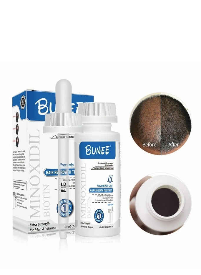 Minoxidil Biotin Prevents Hair Loss Hair Regrowth Treatment 60 ML