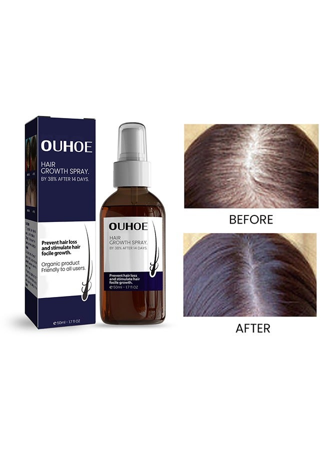 Hair Growth Spray, Hair Growth Serum Spray, Ultra Hair Growth Formula Serum Spray