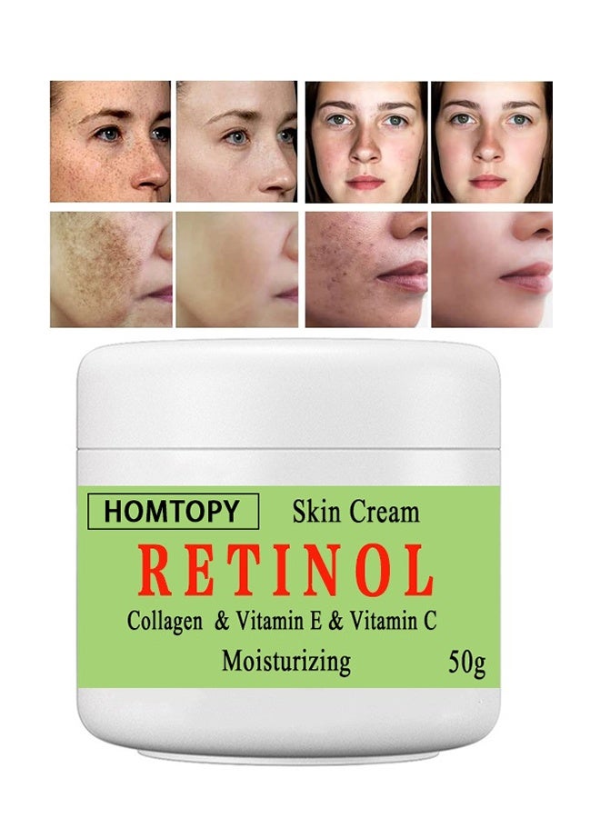 Retinol &Collagen & Vitamin E &Vitamin C  Moisturizing Skin Cream, Dark Spot Remover For Face For Face Snd Body Hyperpigmentation, Fades Melasma, Freckle, Sun Spots, Evens Skin Tone, Age Spot Remover 50g