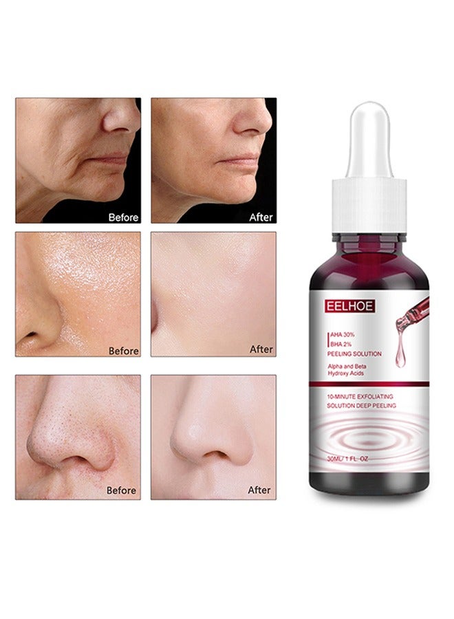 Peeling Solution - AHA30%+BHA 2% salicylic acid essence,Tone Moisturizing Repair, Powerfulexfoliation and Deepcleamsingofpores,30ml