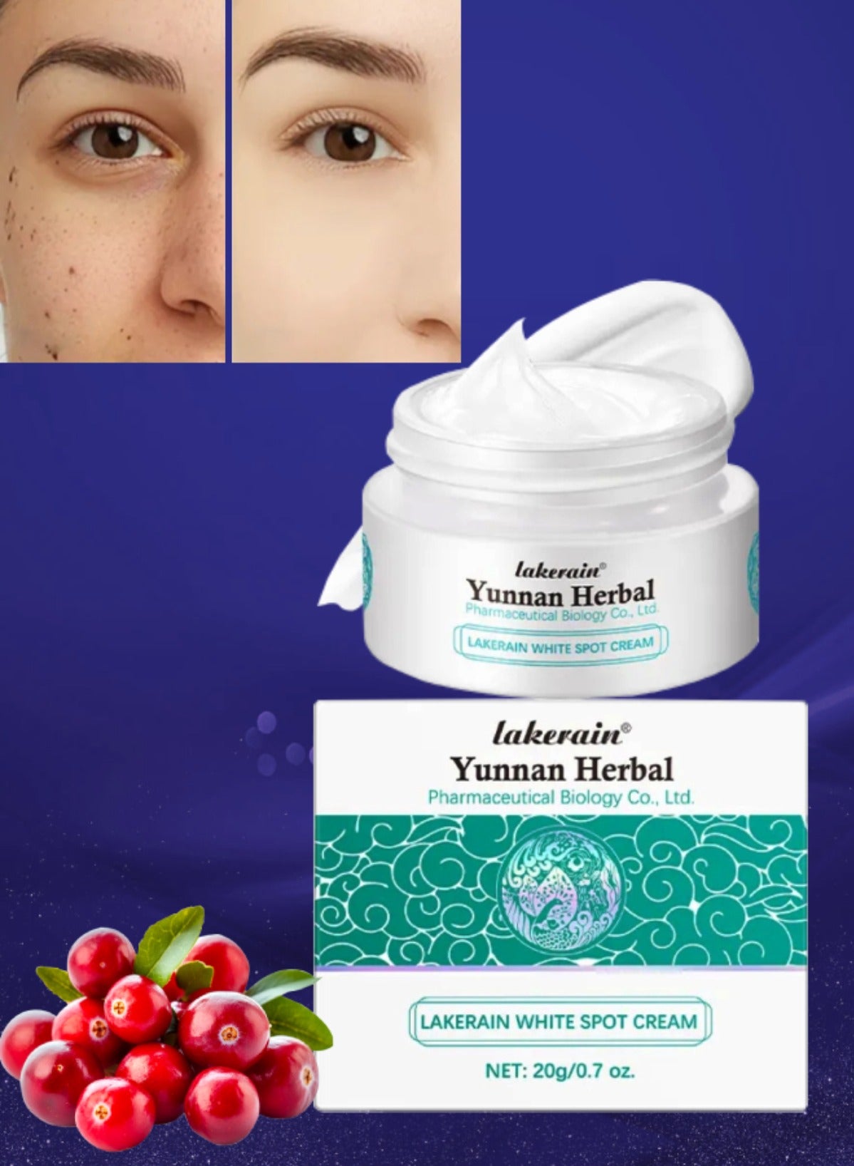 Yunnan Herbal White Spot Cream Anti Freckle Anti Aging Fade Dark Spots and Fine Lines Sunspots Cream Moisturize Hydrate Nourish Smooth Skin Whitening and Freckle Removal Melasma Cream 20g
