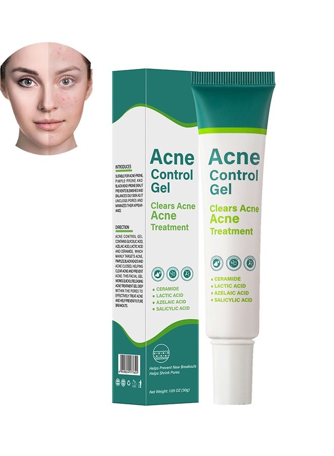 Acne Control Gel, Clears Acne Acne Treatment, Acne Treatment Cream, Acne Spot Treatment gel, Pimple Cream for Acne Prone Skin Care, Clear Acne Spot Treatment Gel, for All Skin Types, 30g