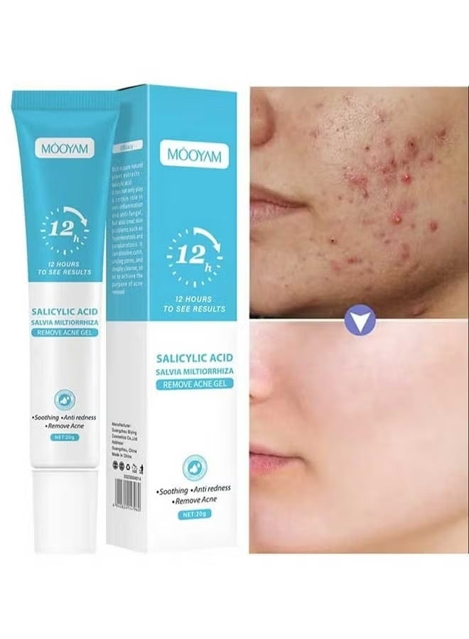 Salicylic Acid Salvia Miltiorrhiza Remove Acne Gel 20g Rapid Action Acne Spot Treatment for Face Lightens Acne Marks Removes Acne and Shrinks Pores Fast Acne Removal in 12 Hours to See Results