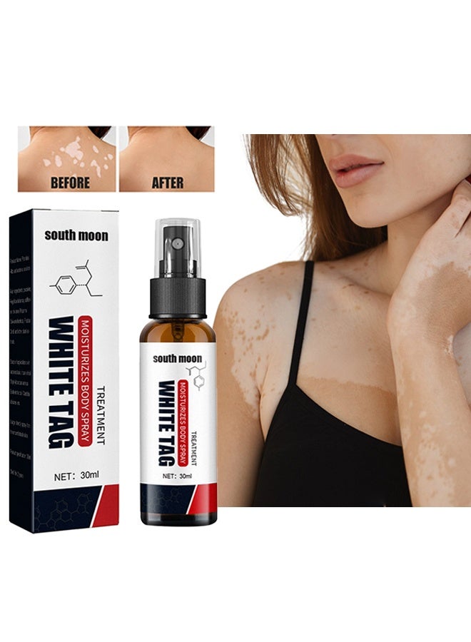 White Tag -Treatment White Spots Moisturizes Body Spray, Skin Repair Spray, Promote Melanin Recovery, Reduces White Spots On Skin And Improve Skin Pigmentation, Vitiligo Care Spray 30ML