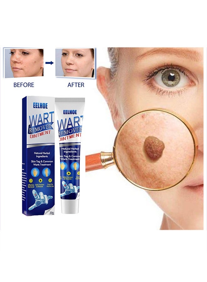 Wart Removal - Natural Herbal Wart Remover Treatment Skin Repair Cream Against Moles Warts Use On Any Parts Of Body 20g