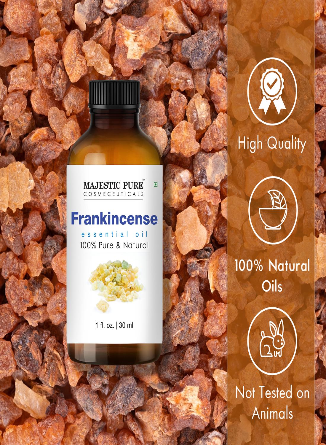 Frankincense Essential Oil, Premium Grade, Pure and Natural, for Aromatherapy, Massage, Topical & Household Uses, 1 fl oz