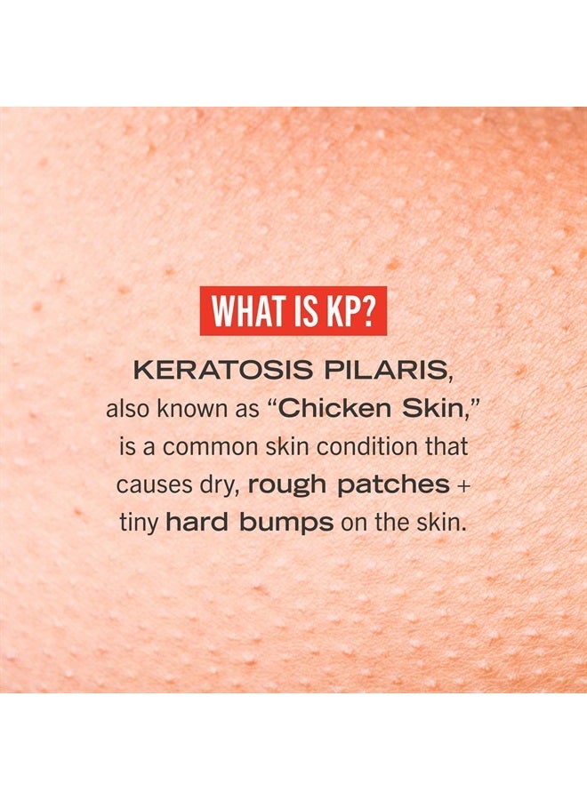 KP Bump Eraser Body Scrub Exfoliant for Keratosis Pilaris with 10% AHA 4 oz.
