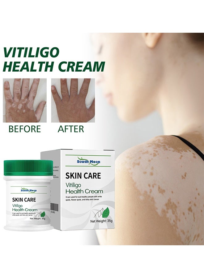 Vitiligo Health Cream, Vitiligo Removal Ointment, Effective Vitiligo Treatment Soothing Cream, Anti Inflammatory White Spot Mycosis Treatment Cream, Soft And Gentle Leukoplakia Disease Cream