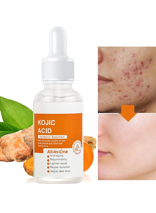 Kojic Acid Turmeric Solution- Reduca The Dark Spots Anti Aging Serum,Lighten Spots,Adjust Skin Tone 30ml