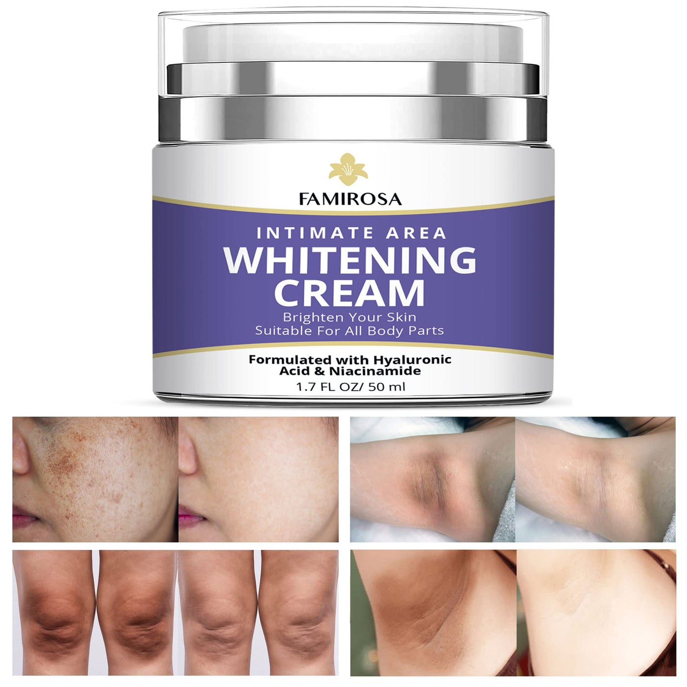 FAMIROSA Intimate Area Dark Spot Corrector: Underarm Cream for Armpit, Knees, Elbows, inner Thigh, Private Parts - Intimate Skin Cream 50 ml