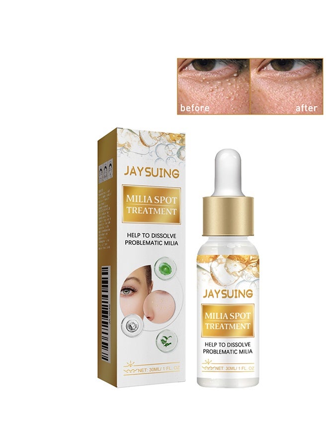 Milia Spot Treatment Helps to Dissolve and Reduce Problematic Remover with Natural Ingredients Gentle on Skin Safe - 30ml