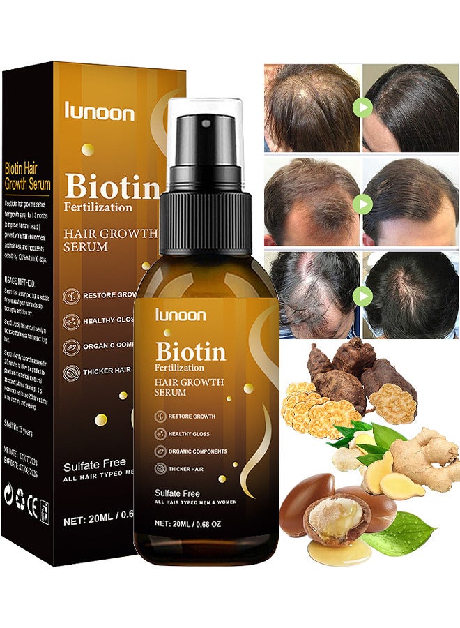 Biotin Hair Growth Serum, Hair Regrowth Spray, Biotin Thickening Herbal Serum, Anti Hair Loss Serum For Hair Growth And Hair Loss, Hair Regrowth For Thicker Longer Fuller Hair, 20ML