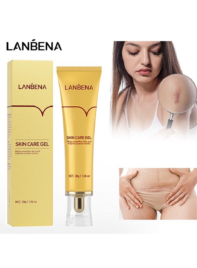 Skin Care Gel， Herbal repair scar cream 30g, scar gel, skin repair gel, natural plant ingredients, effectively repair old and new scars, burns, stretch marks, acne, sunburn (30g)